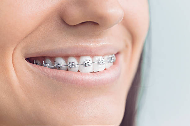 Best Invisalign and Clear Aligners  in Glenn Dale, MD